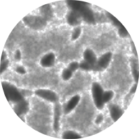malaria